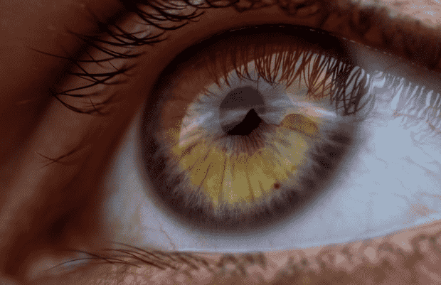 Colored eye