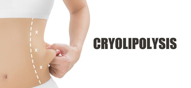 Cryolipolysis